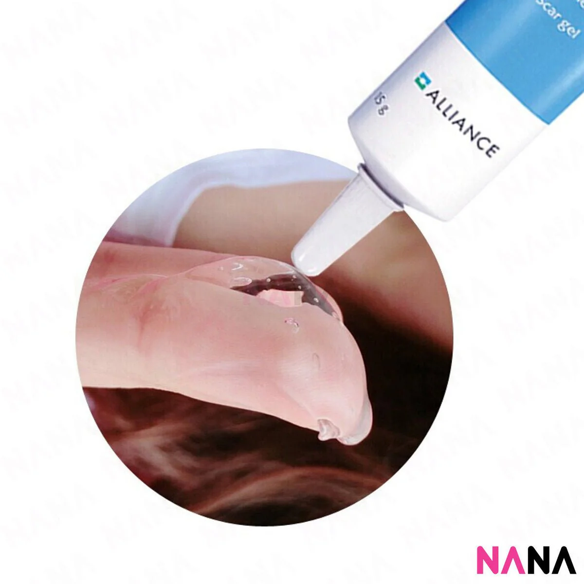 Alliance Kelo-Cote Gel for Scars 15g - Image 5