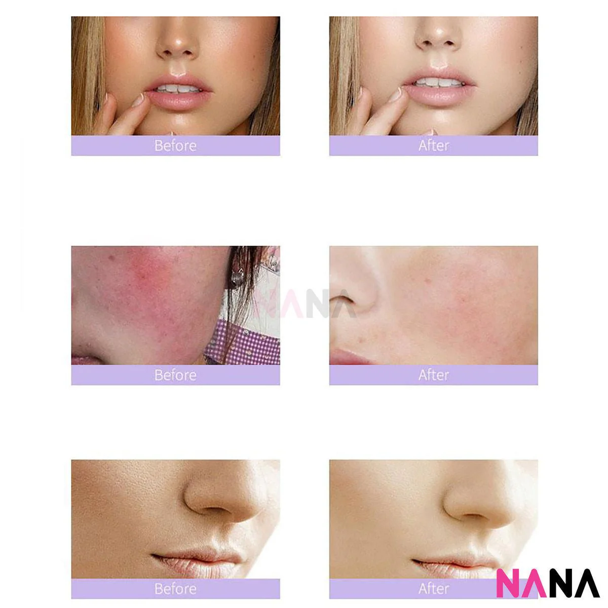 Eaoron Miracle Soothing Mask (5 Sheets/ Box) - Image 5