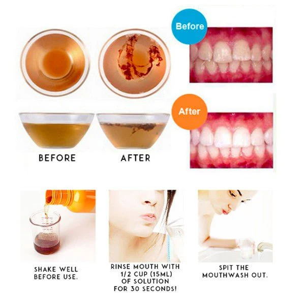 Propolinse Natural Oral Mouth Wash from Japan - Original 600ml - Image 5