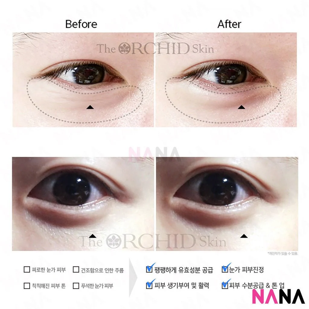 The Orchid Skin Orchid Elastic Under Youth Eye Patch (10 pairs) [Plus Upgrade] x 2 - Image 4