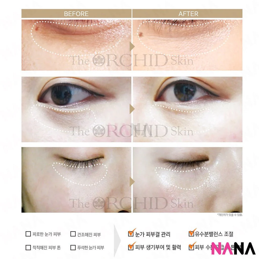 The Orchid Skin Orchid Smoky Under Clear Eye Patch (10 pairs) [Plus Upgrade] x 2 - Image 4