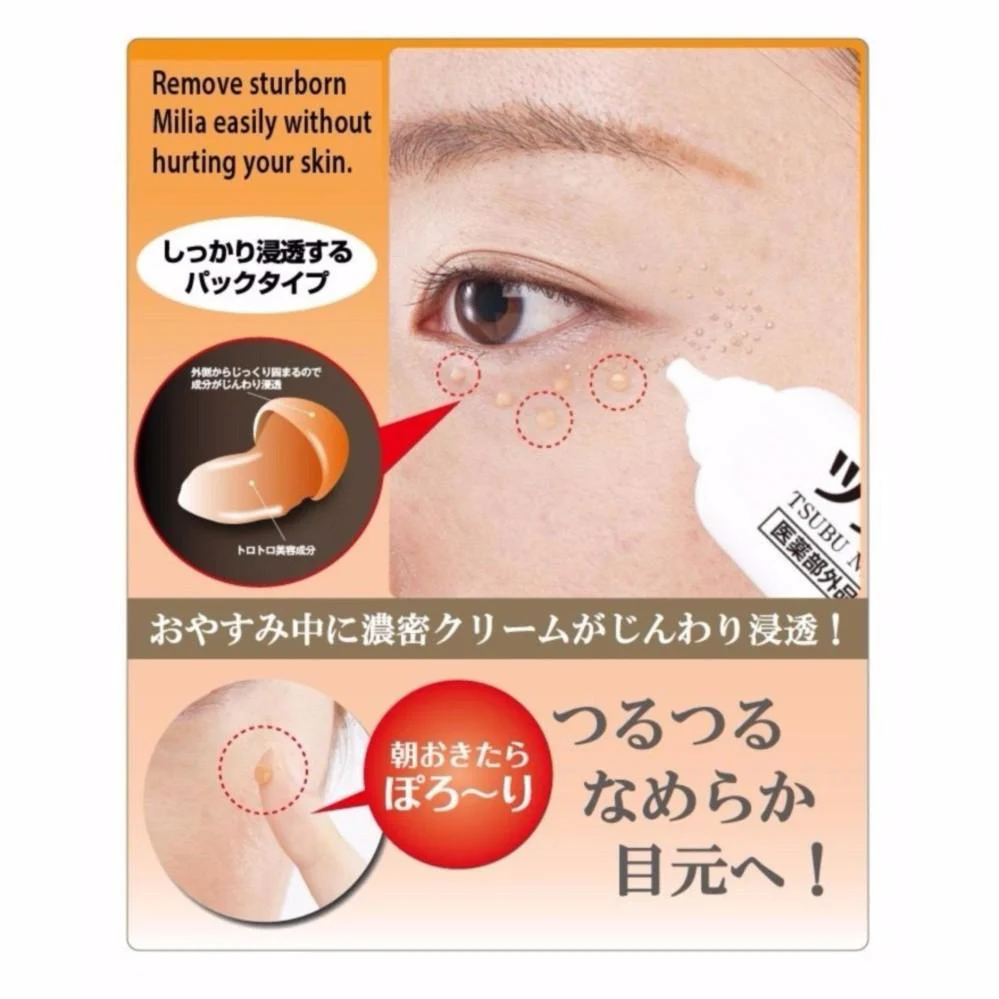 Tsubu Night Pack Wart Remover Cream 30g - Image 3